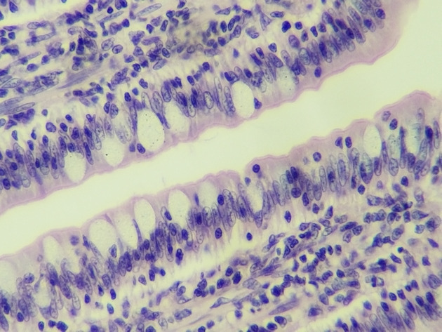 Simple Columnar Epithelium Slides - Simple Columnar Epithelium 07 400X